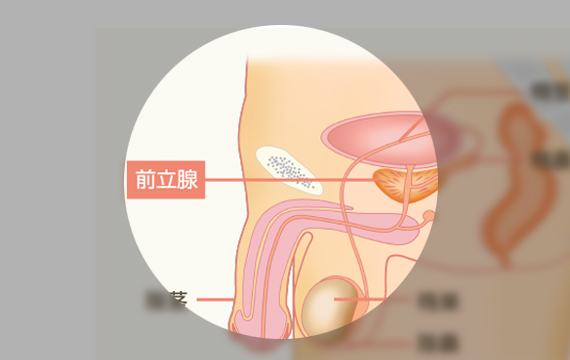 09.前立腺