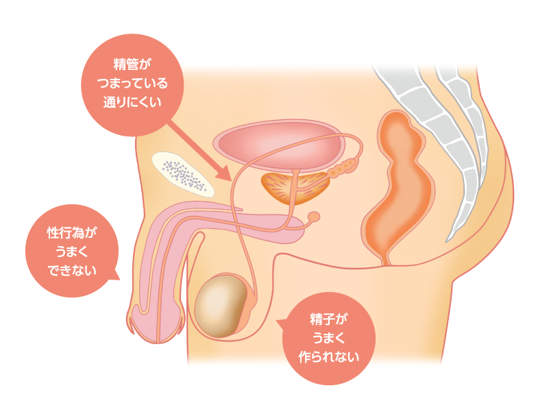 04.男性の原因